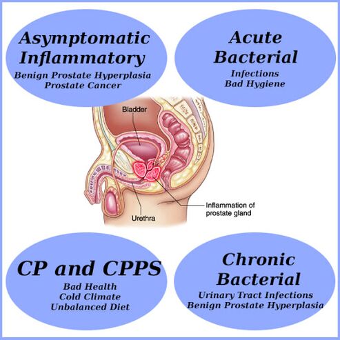 Las causas de la prostatitis